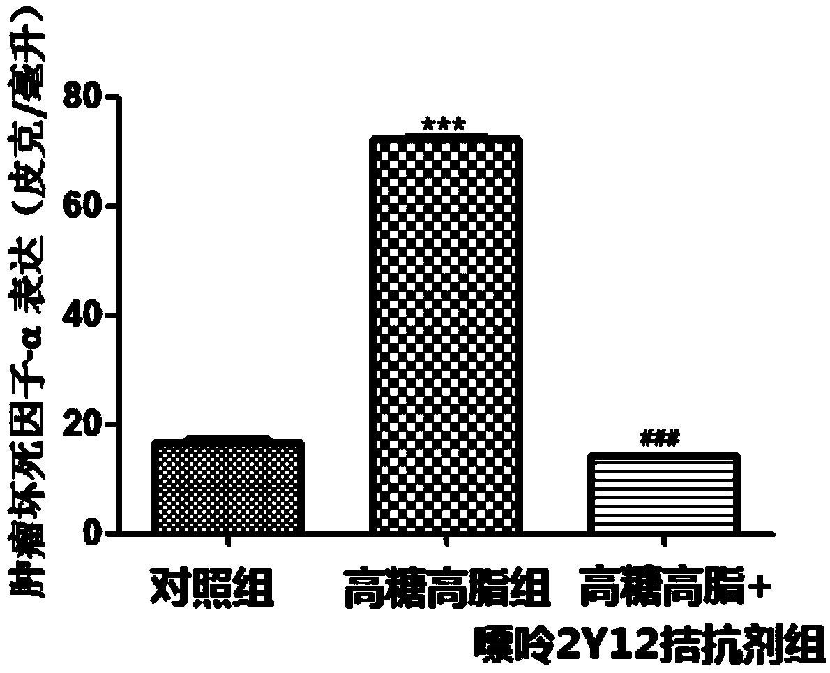 Application of purine 2Y12 receptor antagonist in preparing medicine for diabetic neuropathological injury diseases