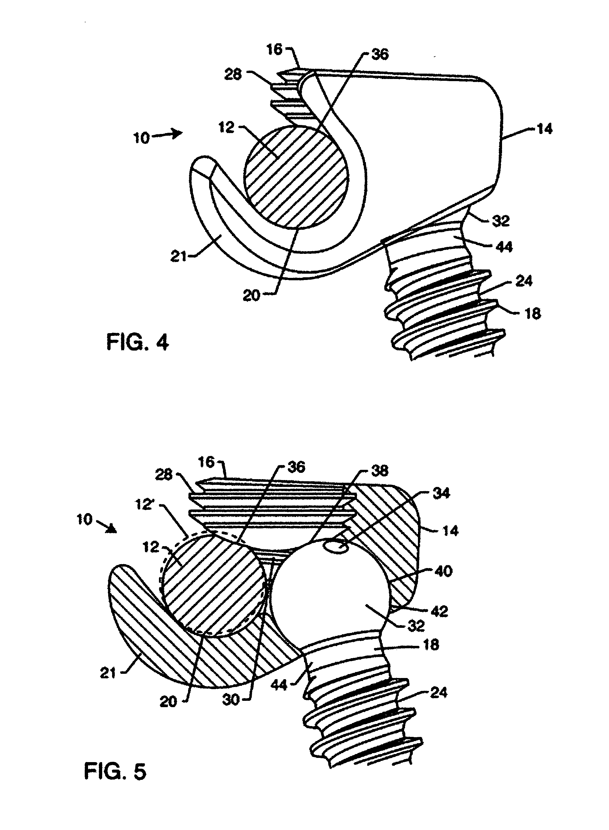 Pedicle screw system with offset stabilizer rod