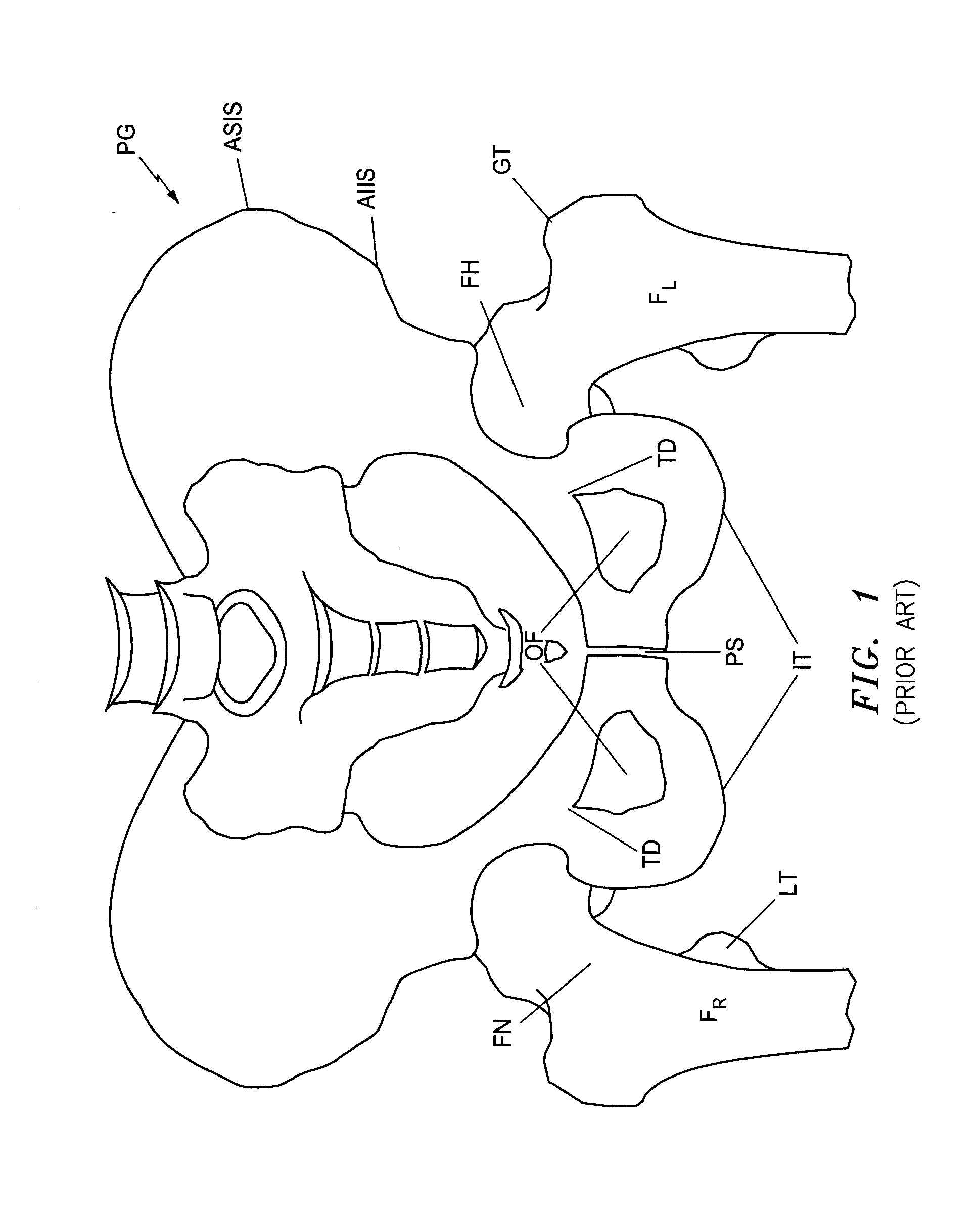 Systems and Methods for Intra-Operative Image Analysis