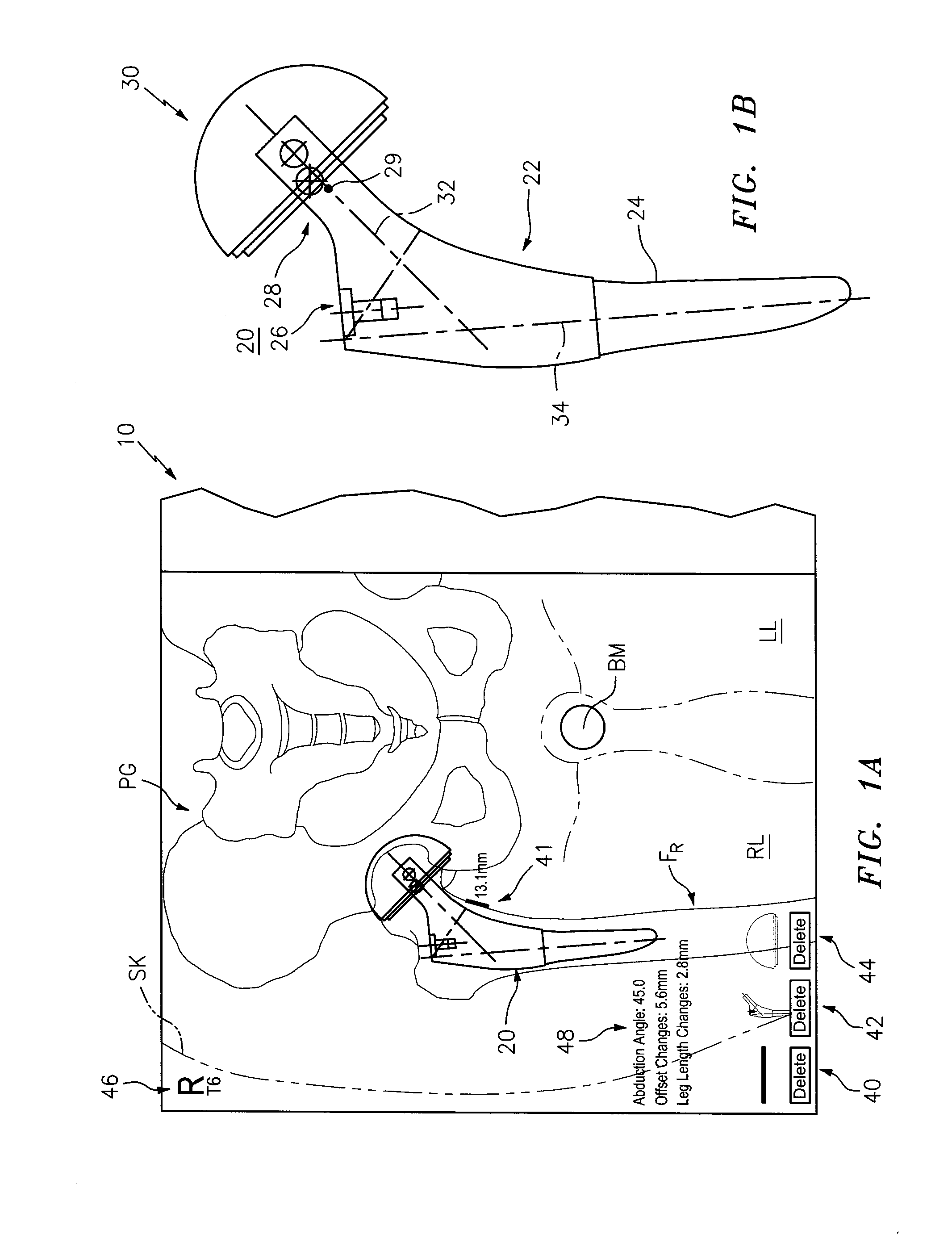 Systems and Methods for Intra-Operative Image Analysis