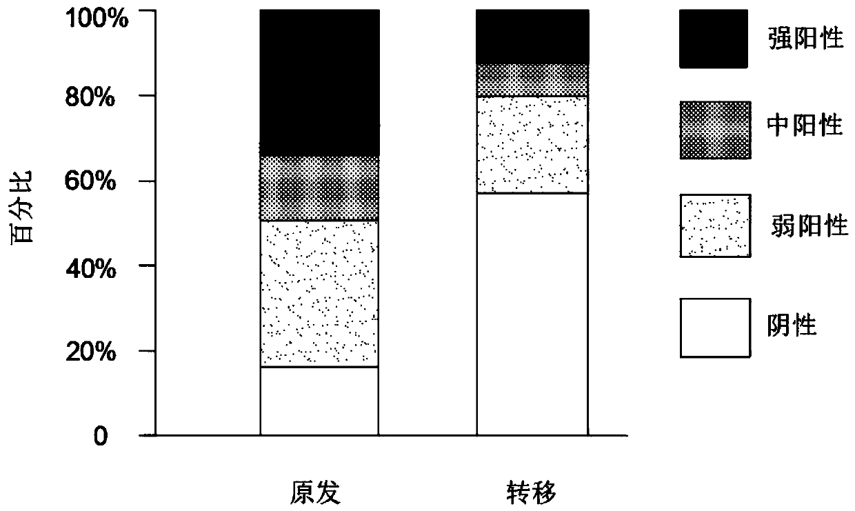 Application of chemokine CXCL14 in predicting prognosis of colon cancer