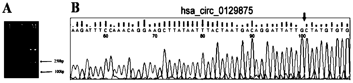 Application of circRNA marker for diagnosing thalassemia