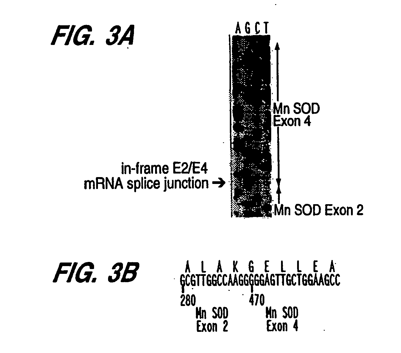 Manganese superoxide dimutase exon 3-deleted isoforms and nucleic acid molecules encoding the isoforms