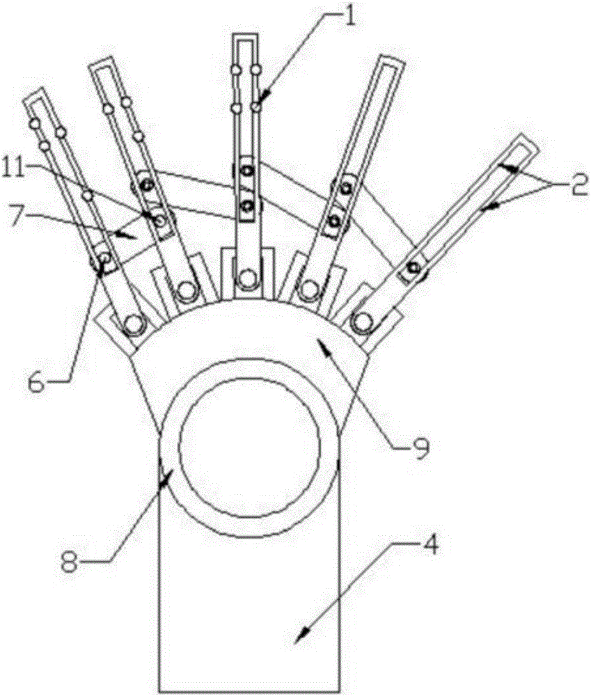 Noninvasive hand bone fixer for preventing osteonecrosis