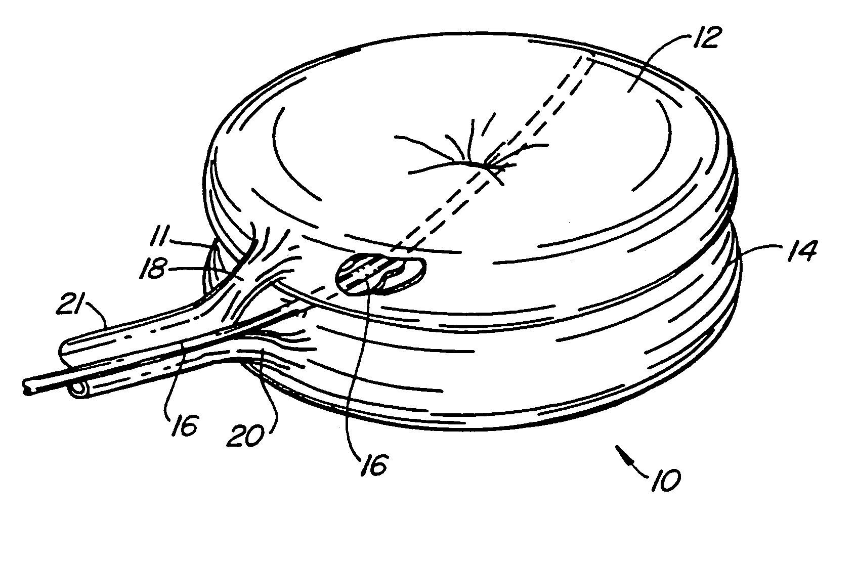 Devices and methods using an expandable body with internal restraint for compressing cancellous bone