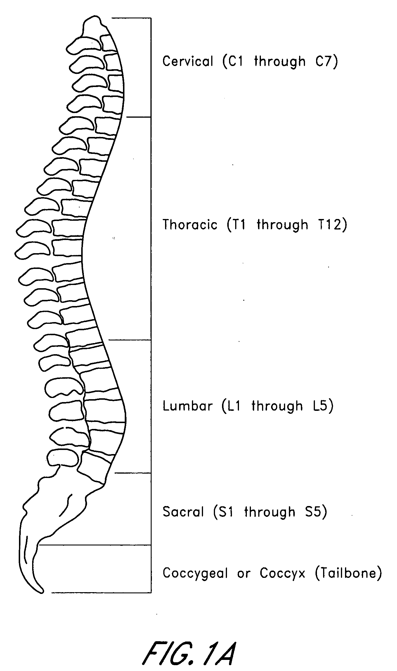 Guide pin for guiding instrumentation along a soft tissue tract to a point on the spine