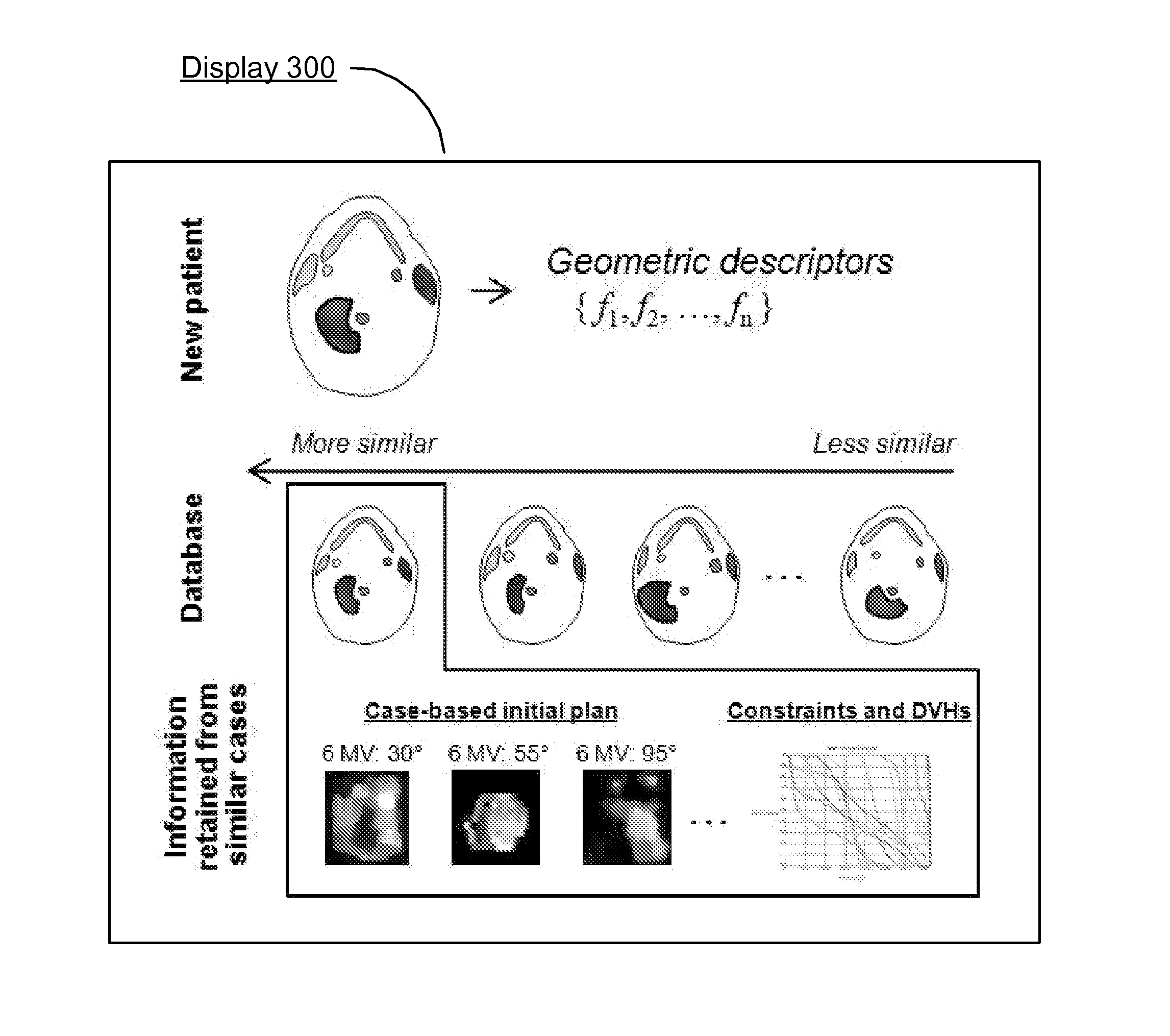 System and method for automatic generation of initial radiation treatment plans