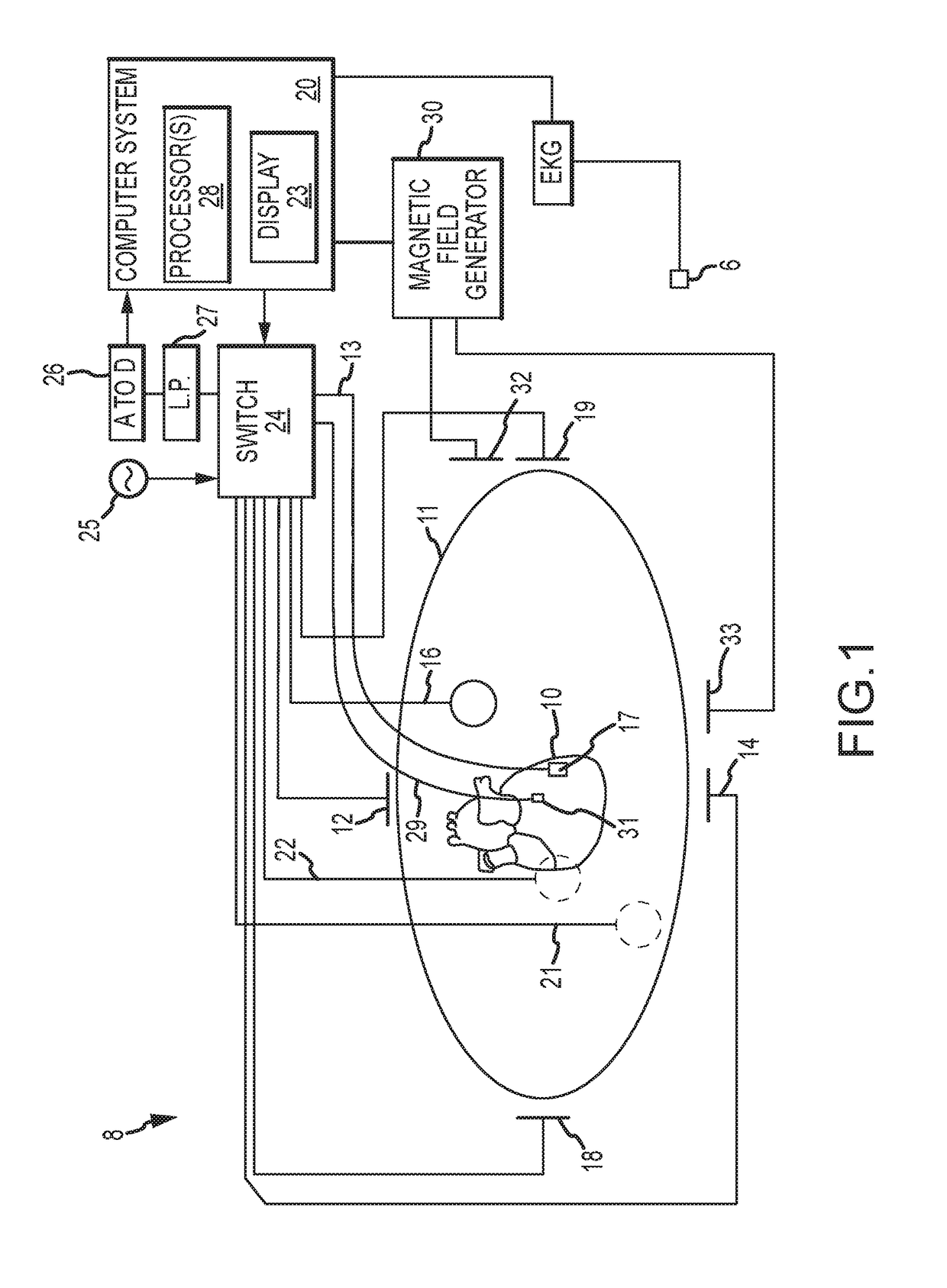 System and Method for Electrophysiology Procedures