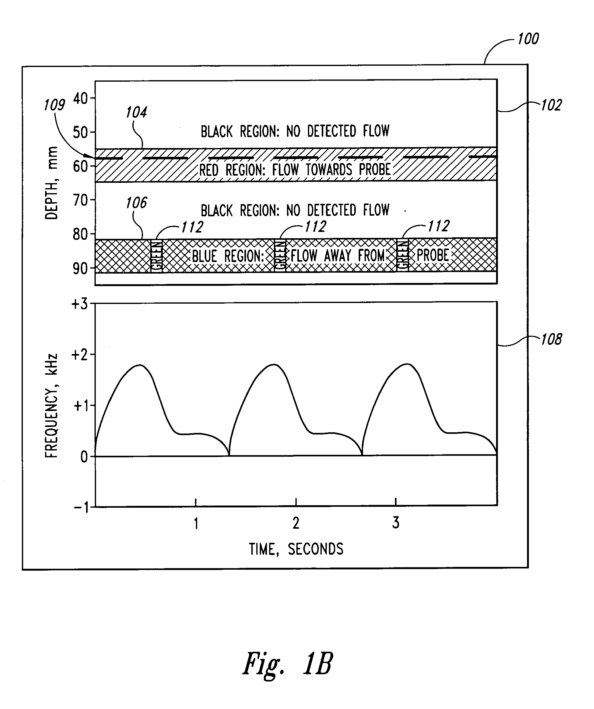 Doppler ultrasound method and apparatus for monitoring blood flow and hemodynamics