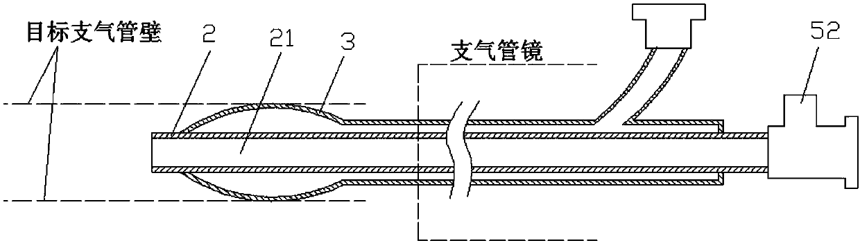 Balloon catheter assembly for bronchoscope