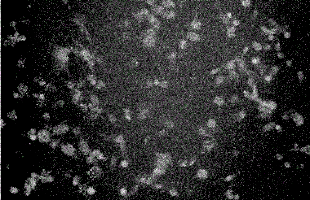 Antisense oligonucleotide of human mir-504 and its application