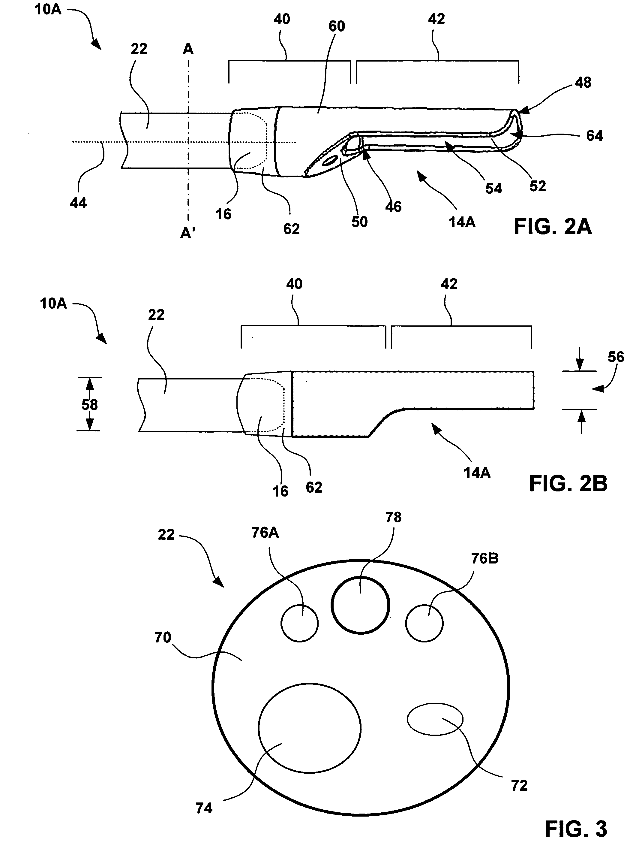 Distal portion of an endoscopic delivery system