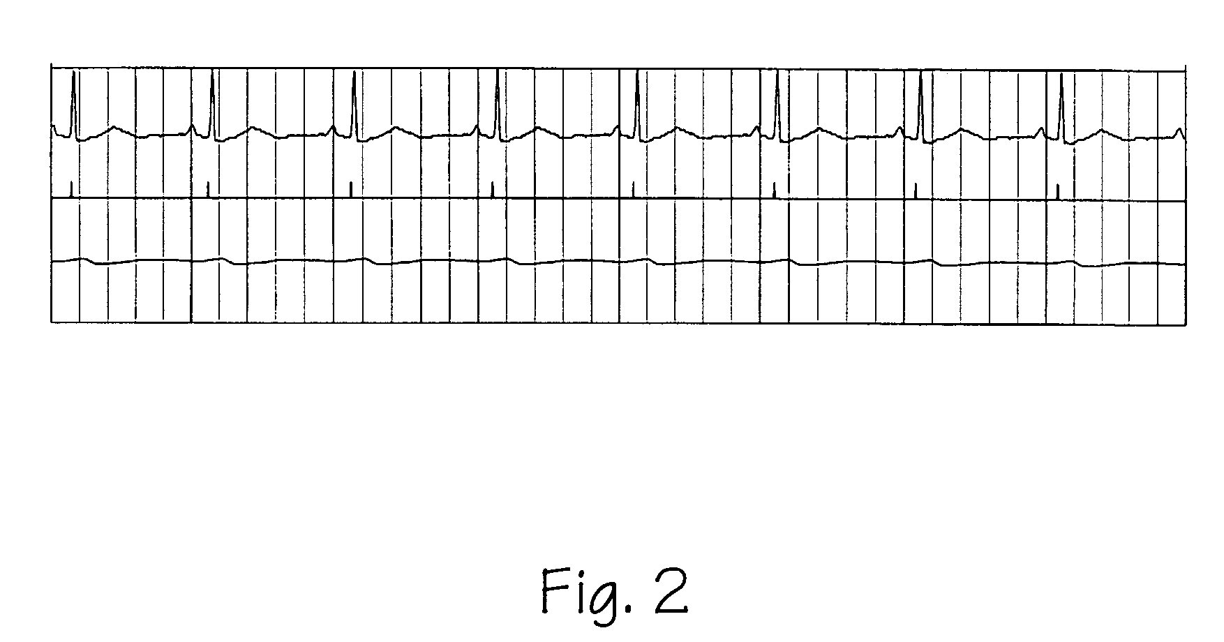 System and method for ICG recording and analysis
