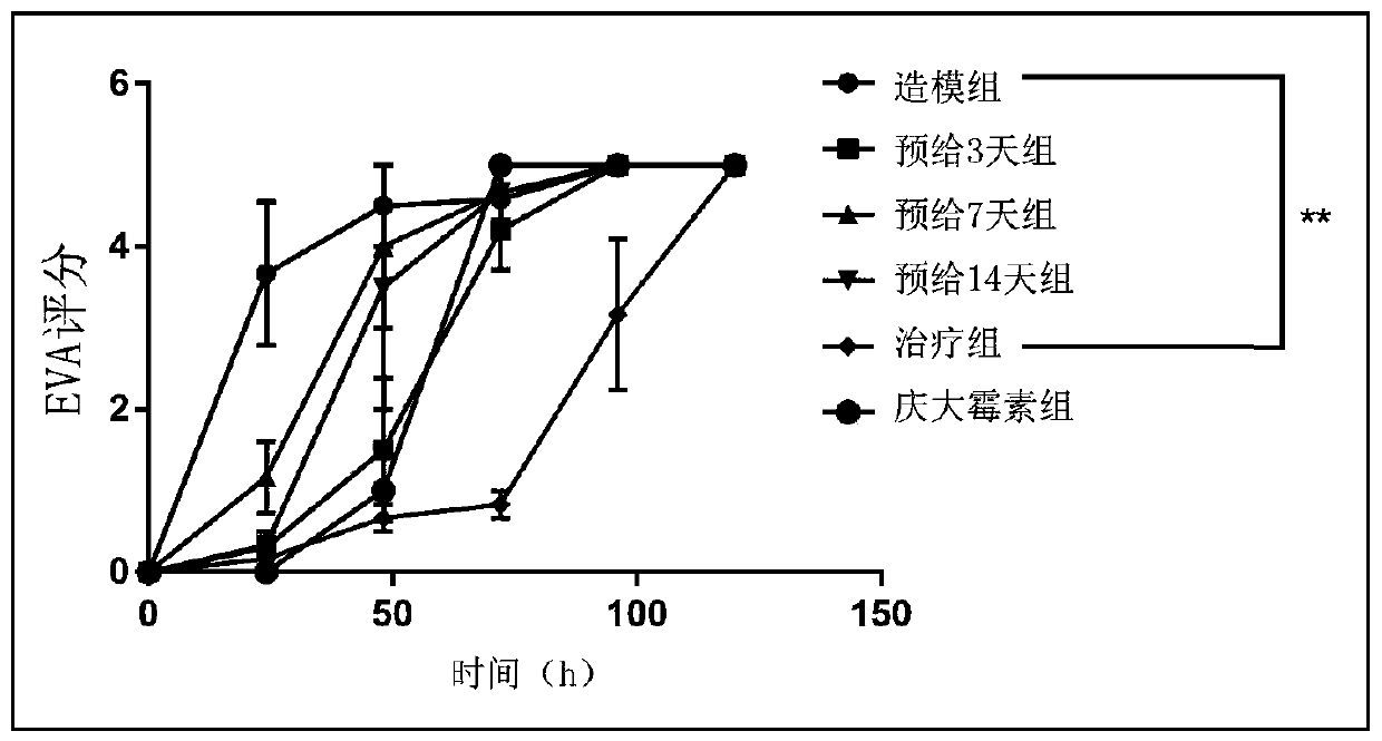 Application of glutathione (GSH) to preparation of drug for preventing and treating central nervous system infection caused by salmonella typhimurium