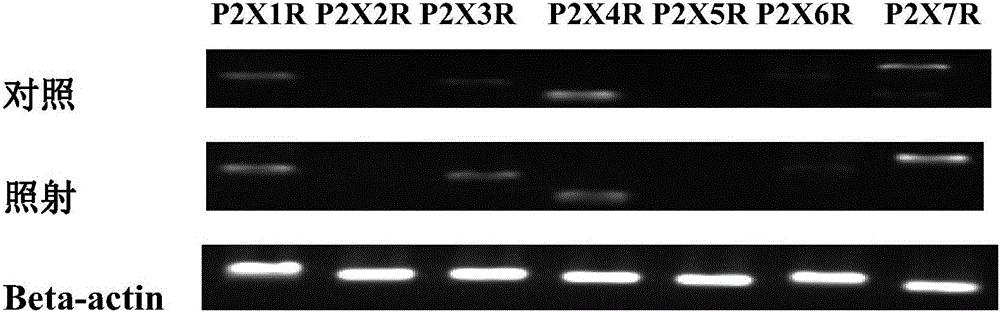 Application of P2X7 receptor inhibitor