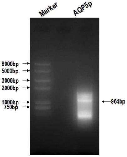 Recombination and drug screening application of aqp5 promoter luciferase reporter gene