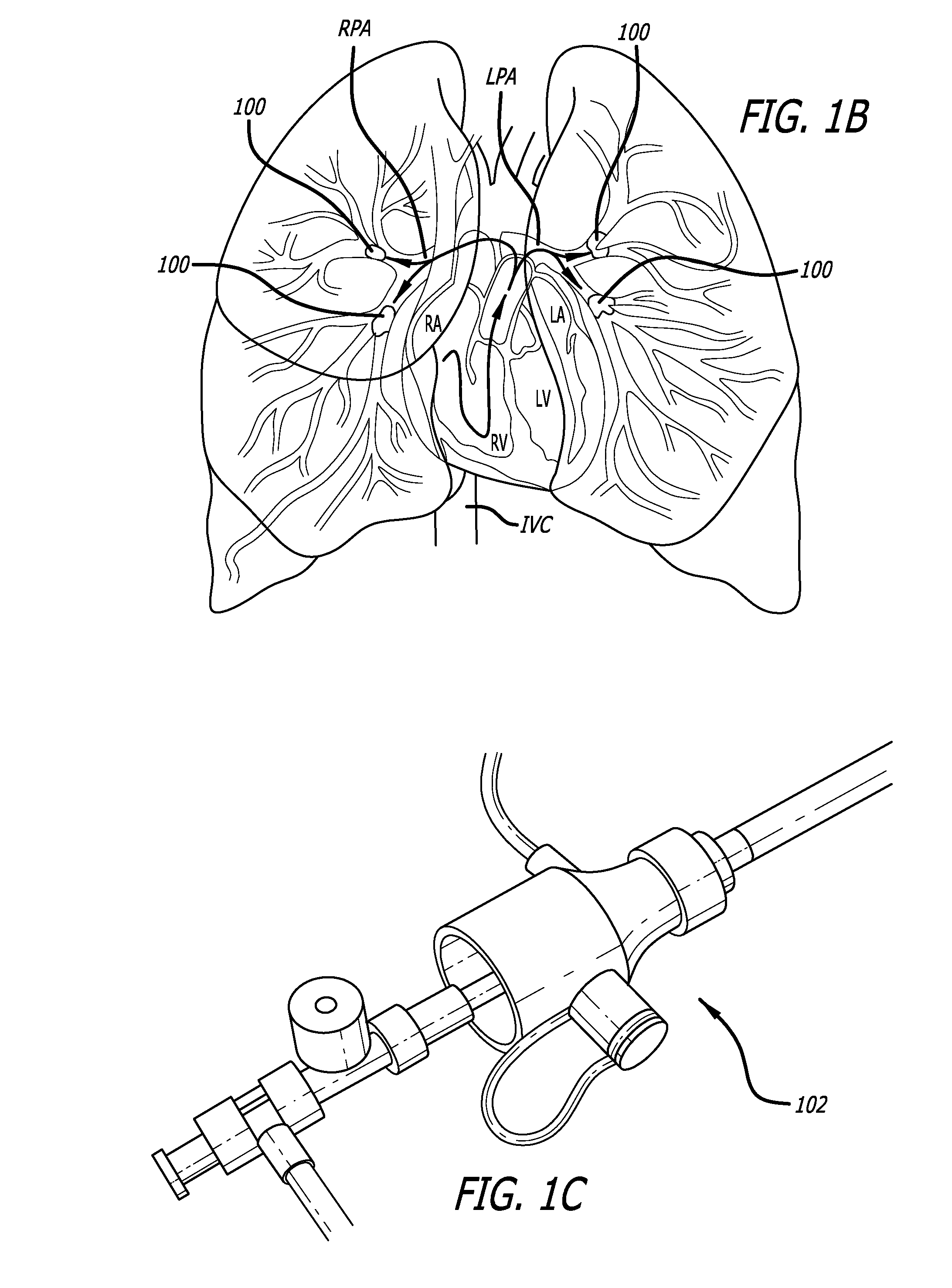Methods And Apparatus For Treating Embolism