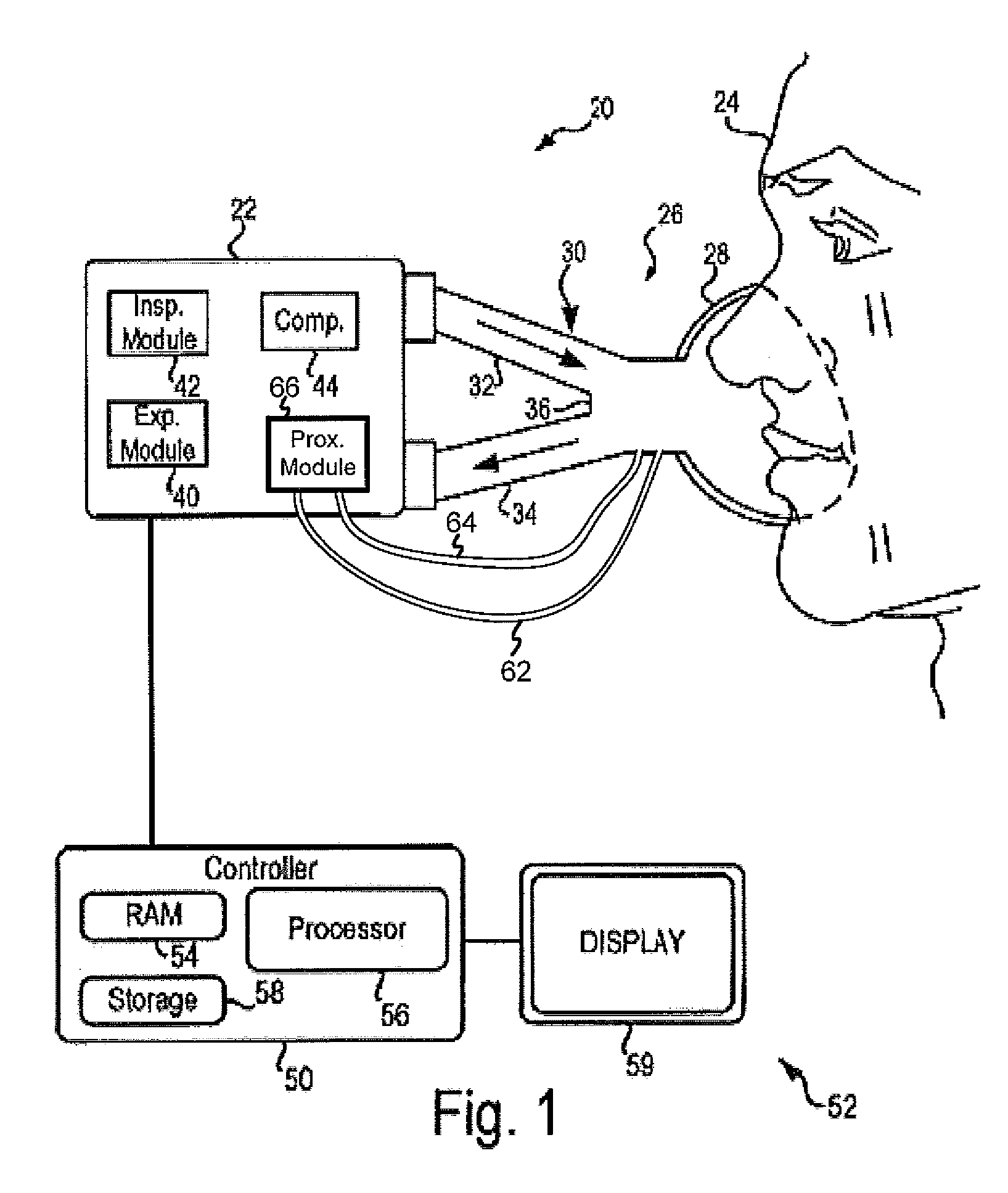 Ventilator With Controlled Purge Function
