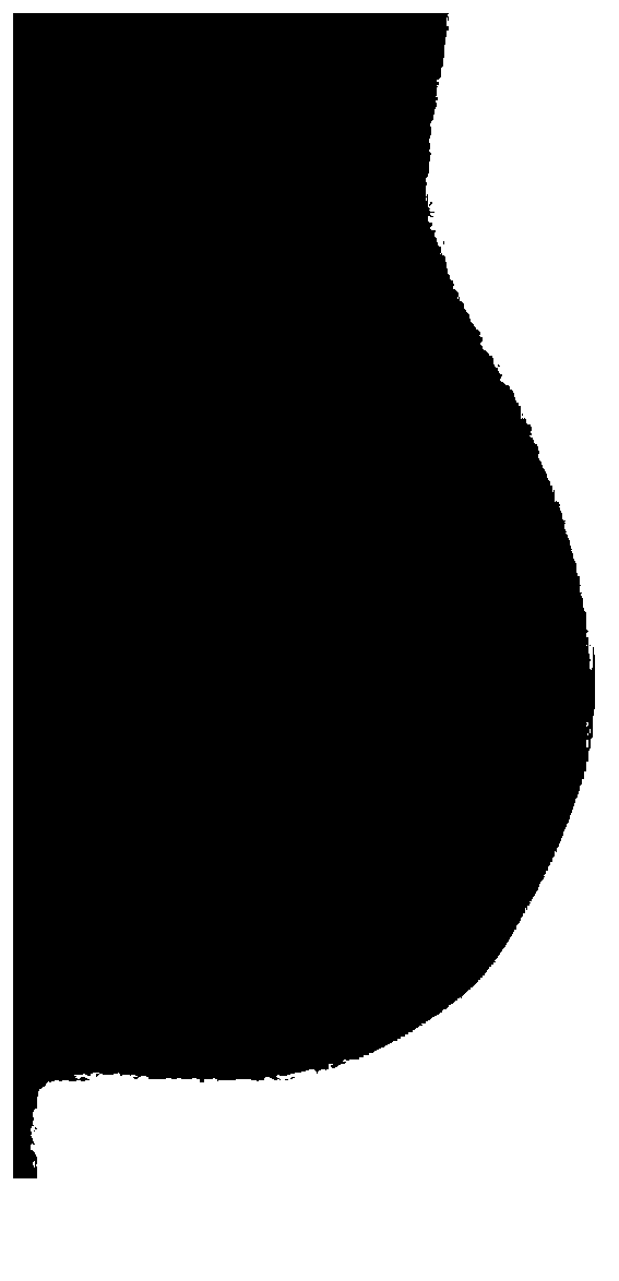 Cutting method of pectoral muscle region in mammary gland X-ray image