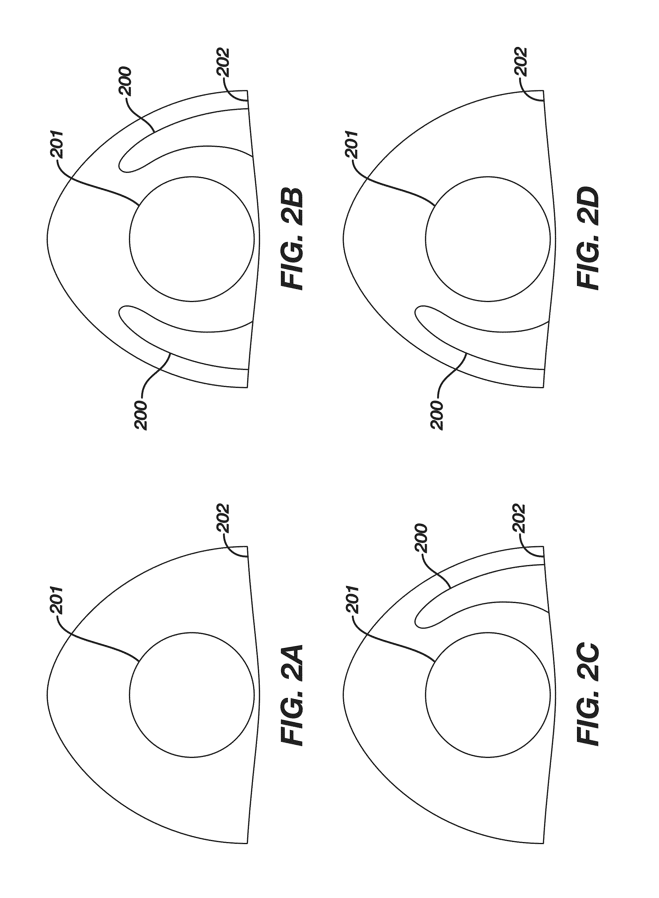 Method and apparatus of forming a translating multifocal contact lens having a lower-lid contact surface
