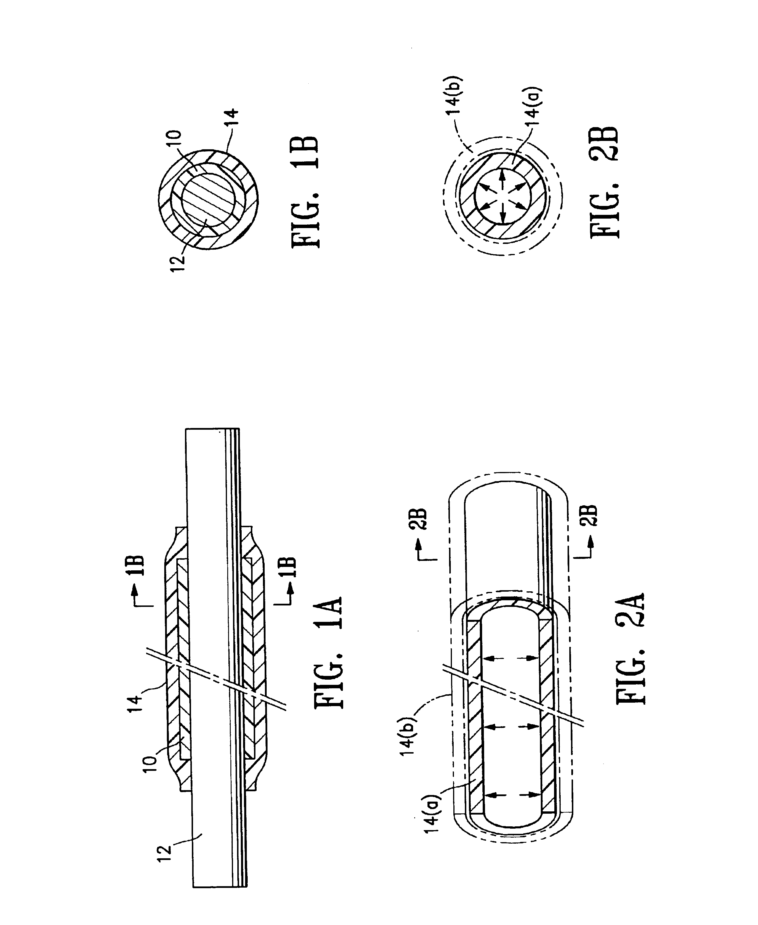 Method of making an expandable medical device formed of a compacted porous polymeric material