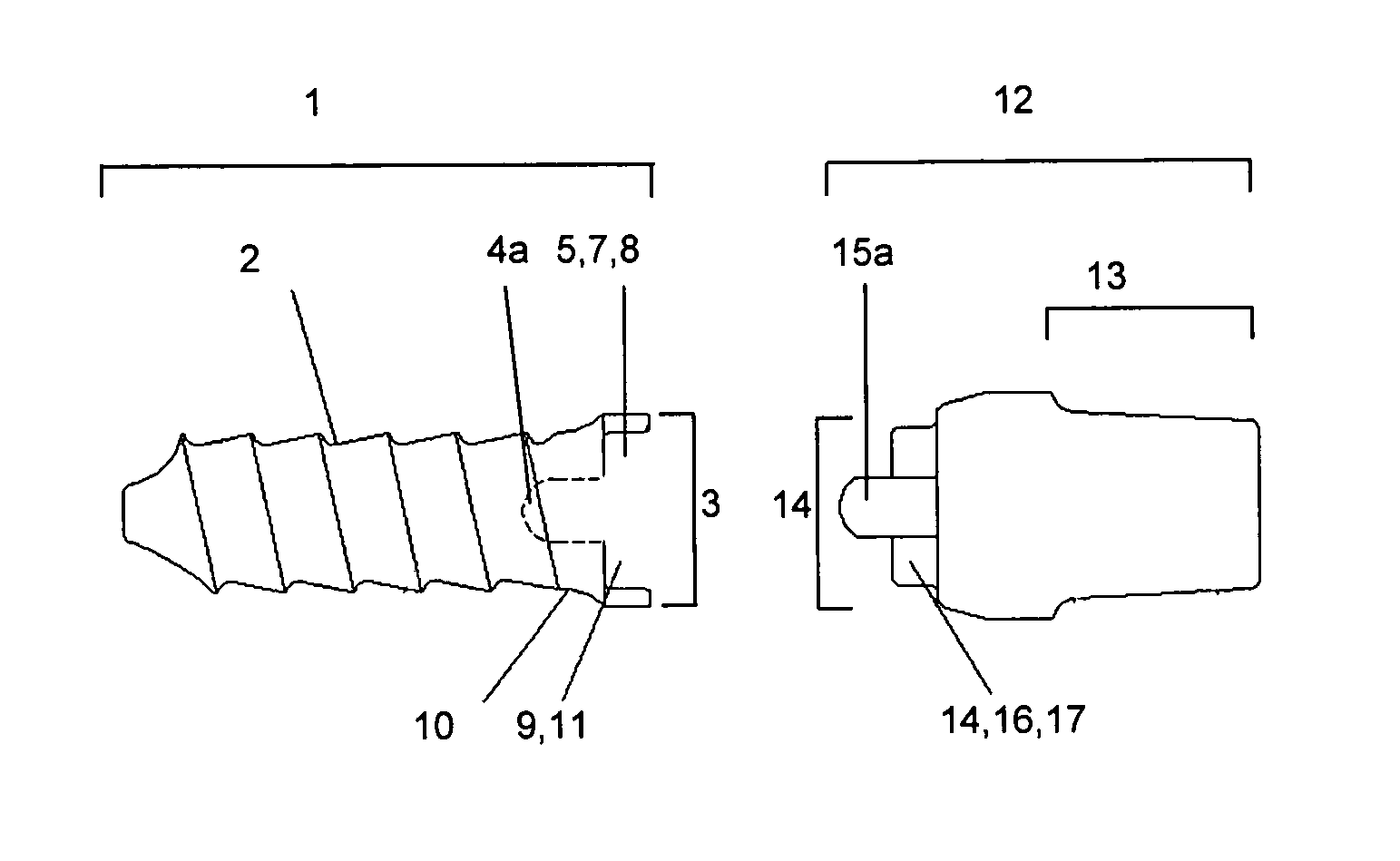 Two-Part Dental Implants