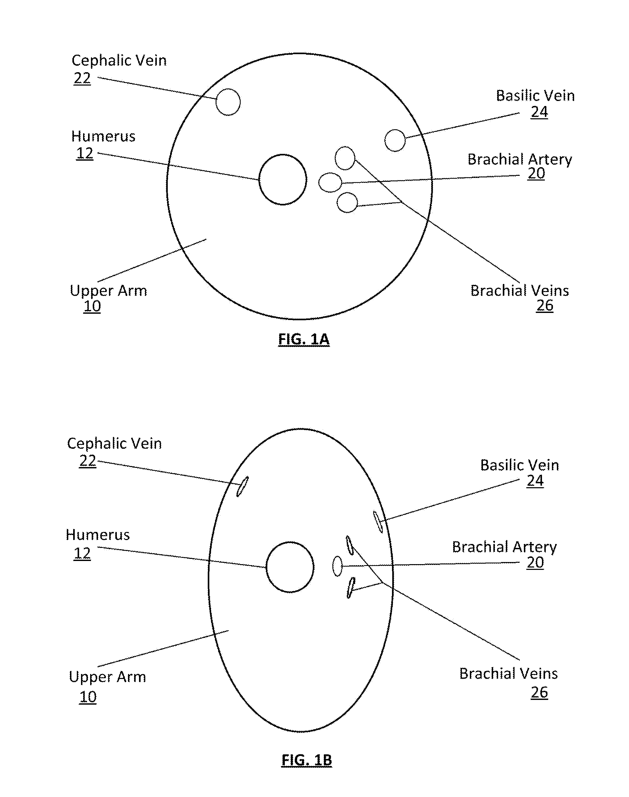 Clamping Device for Reducing Venous Blood Flow