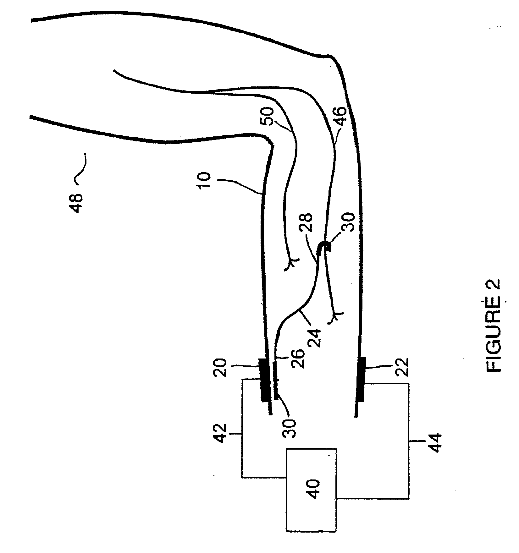 Method and system for controlled nerve ablation