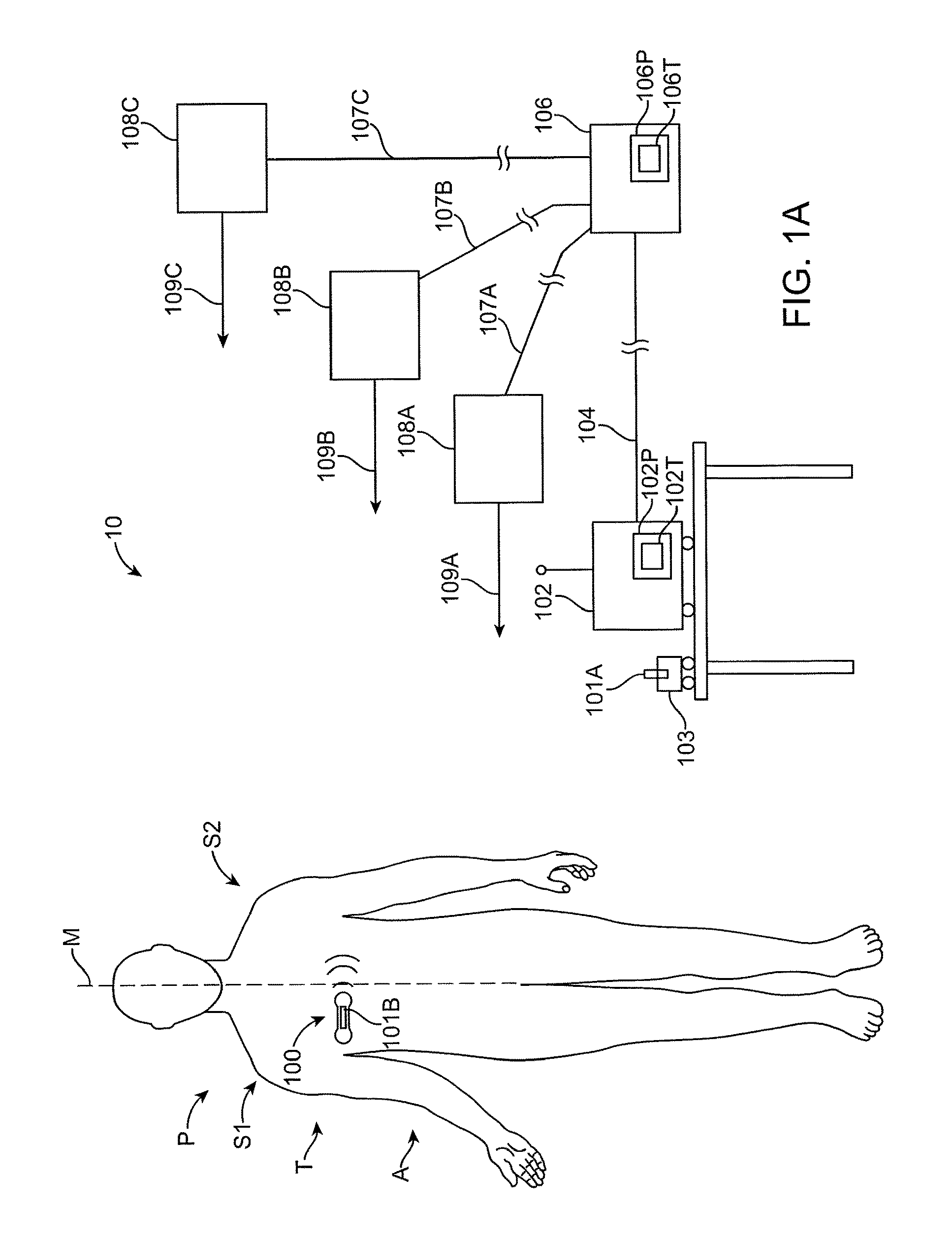 Method and apparatus for remote detection and monitoring of functional chronotropic incompetence