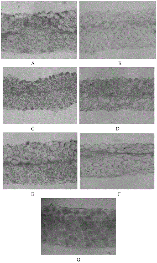 Application of interfering expression of lcyb and lcye while overexpressing gl3 in preparing Brassica plants with red petals