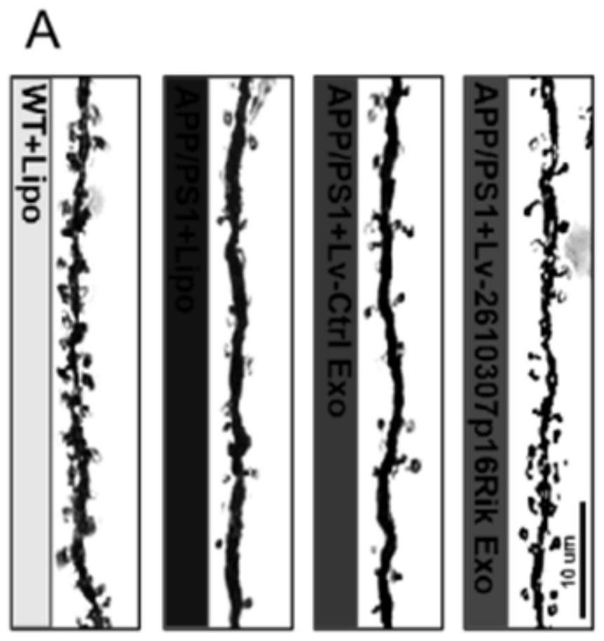 Application of exosome mediated RNA CASC15 in intervention of synaptic loss of Alzheimer's disease