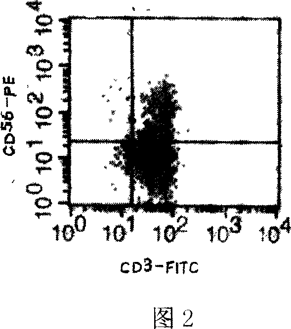 Preparation method for CIK cell with high proliferation and high cell cytotoxic activity