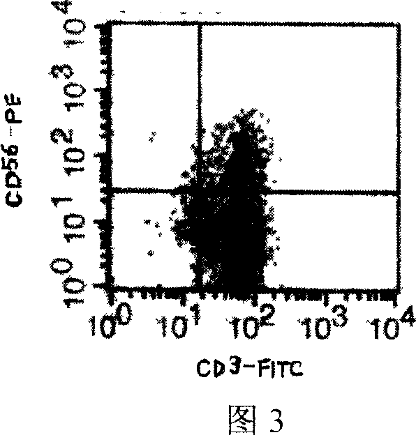 Preparation method for CIK cell with high proliferation and high cell cytotoxic activity
