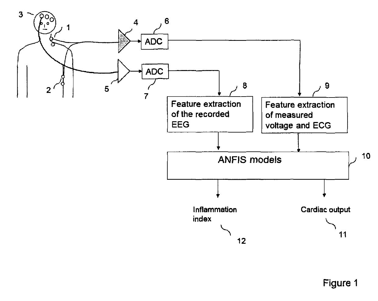 Methods and apparatus for the on-line and real time acquisition and analysis of voltage plethysmography, electrocardiogram and electroencephalogram for the estimation of stroke volume, cardiac output, and systemic inflammation