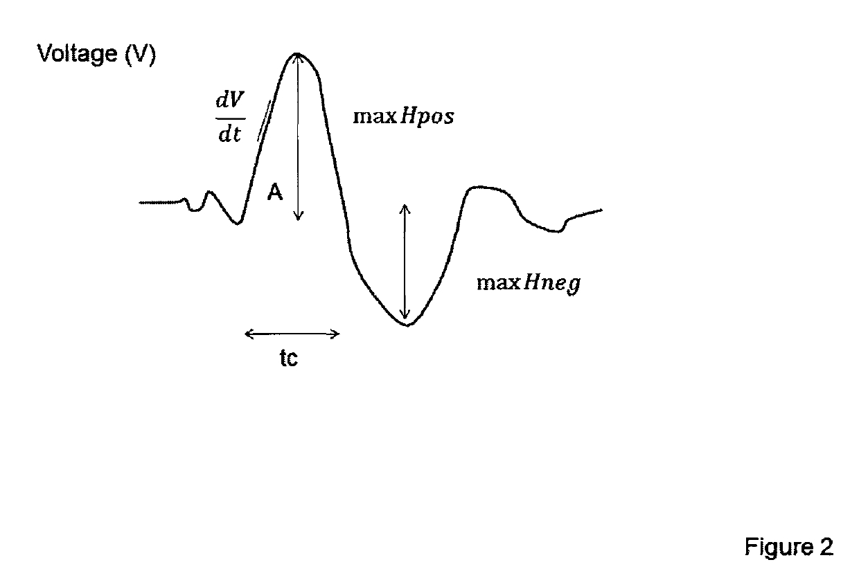 Methods and apparatus for the on-line and real time acquisition and analysis of voltage plethysmography, electrocardiogram and electroencephalogram for the estimation of stroke volume, cardiac output, and systemic inflammation