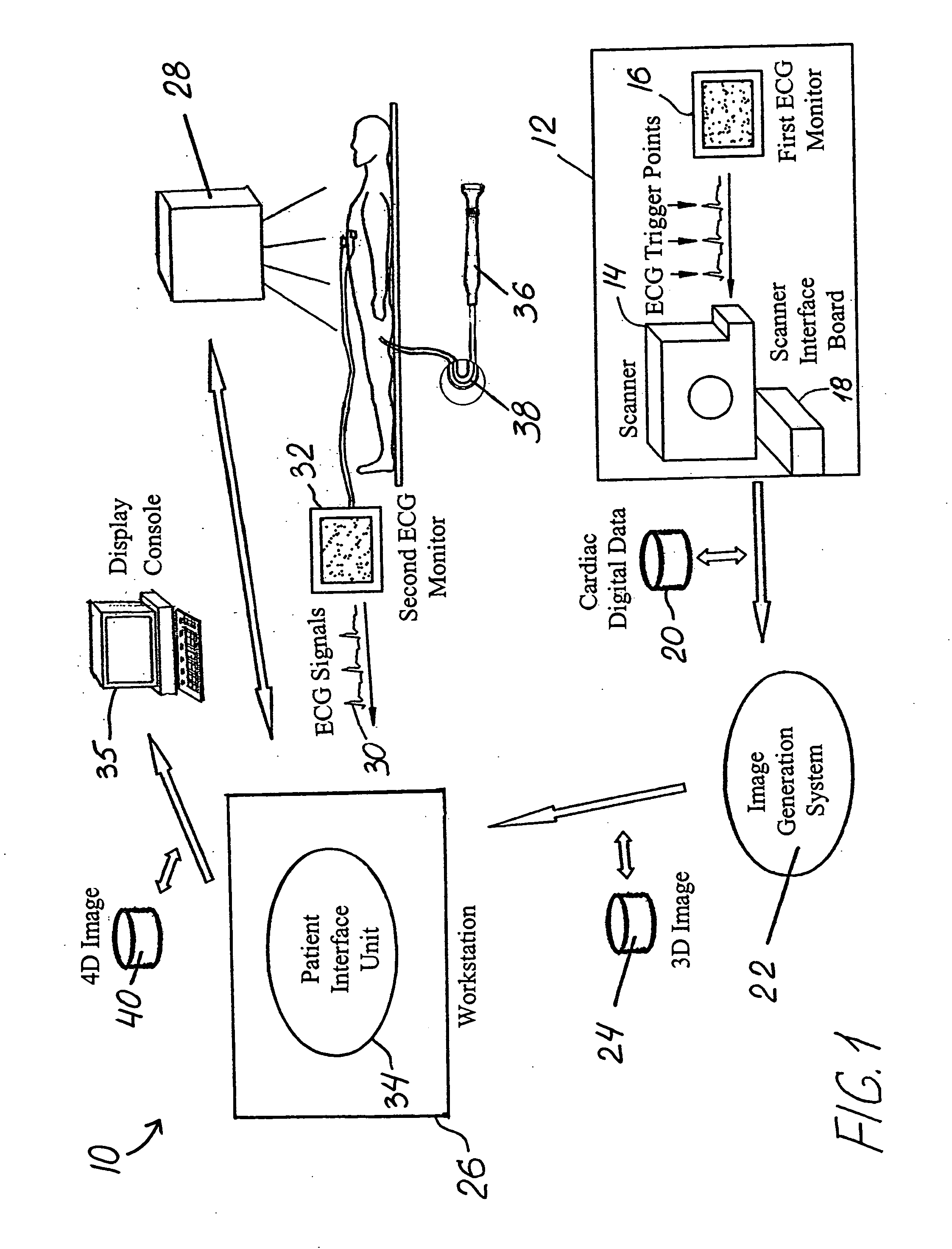 Method and system of treatment of heart failure using 4D imaging