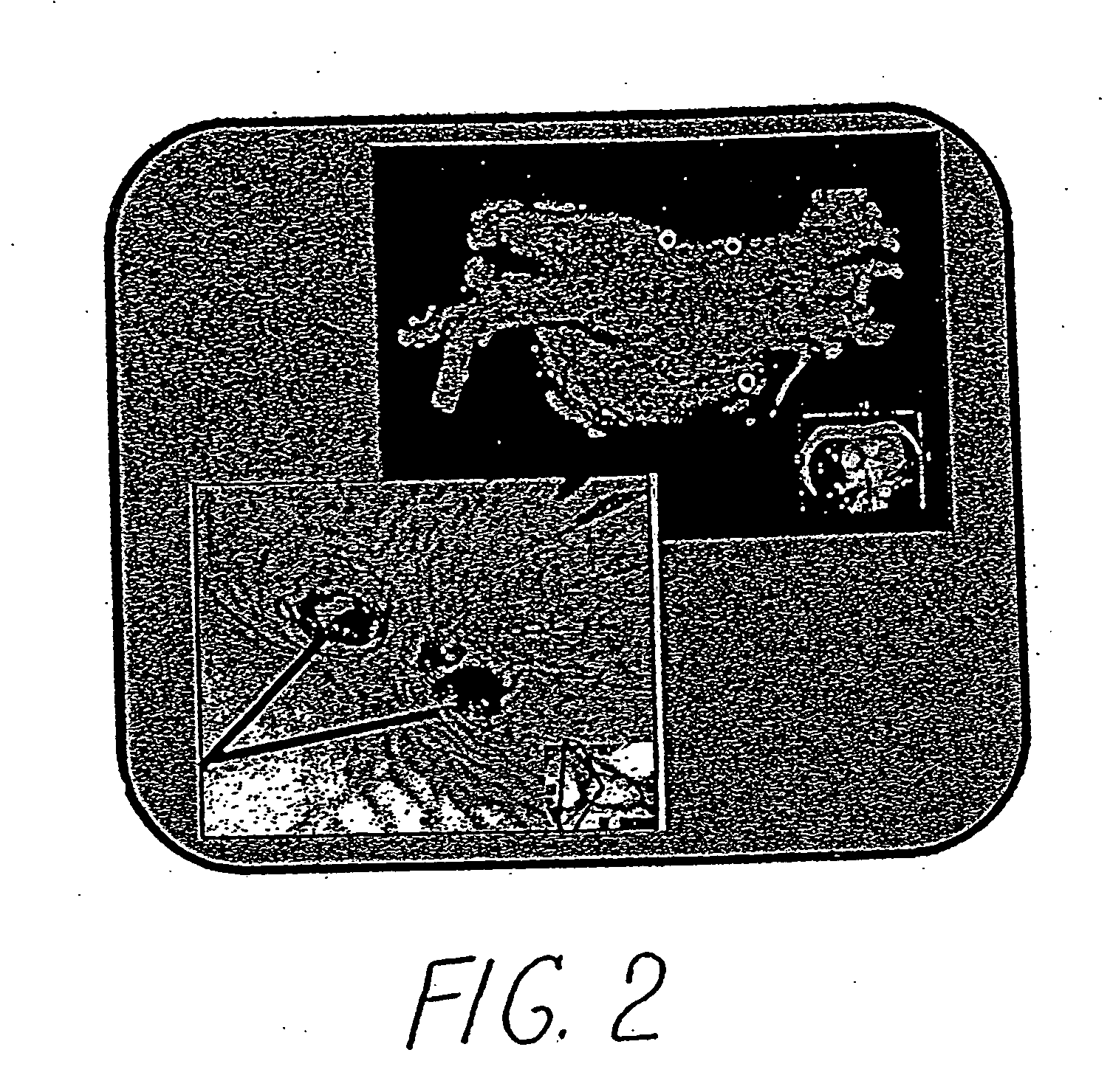 Method and system of treatment of heart failure using 4D imaging