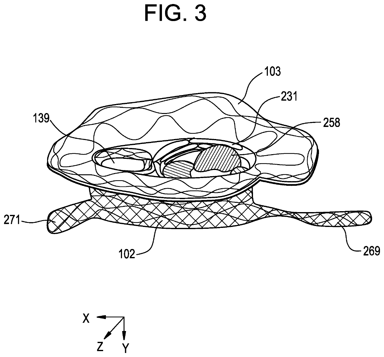 Collapsible Inner Flow Control Component for Side-Delivered Transcatheter Heart Valve Prosthesis