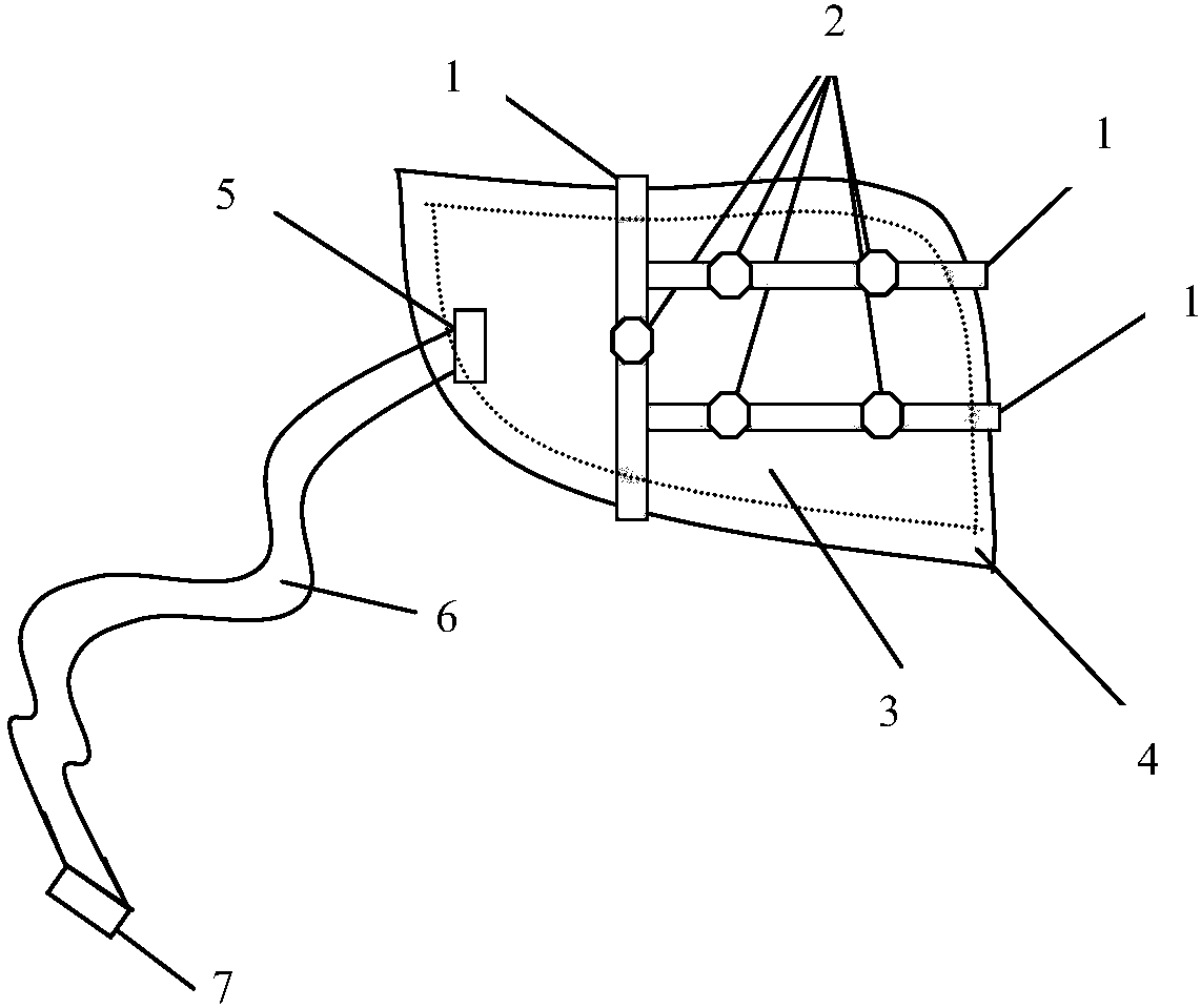 An orthopedic fixator for the exterior of the clavicle