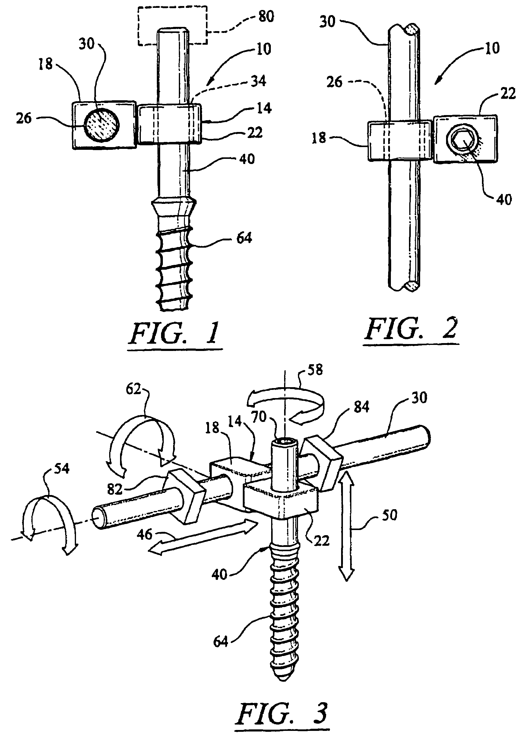 Method for creating an artificial facet