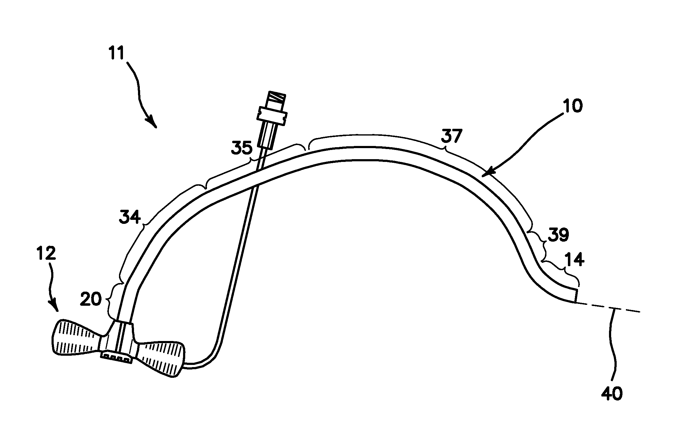 Method and Apparatus for a Right-Sided Short Sheath