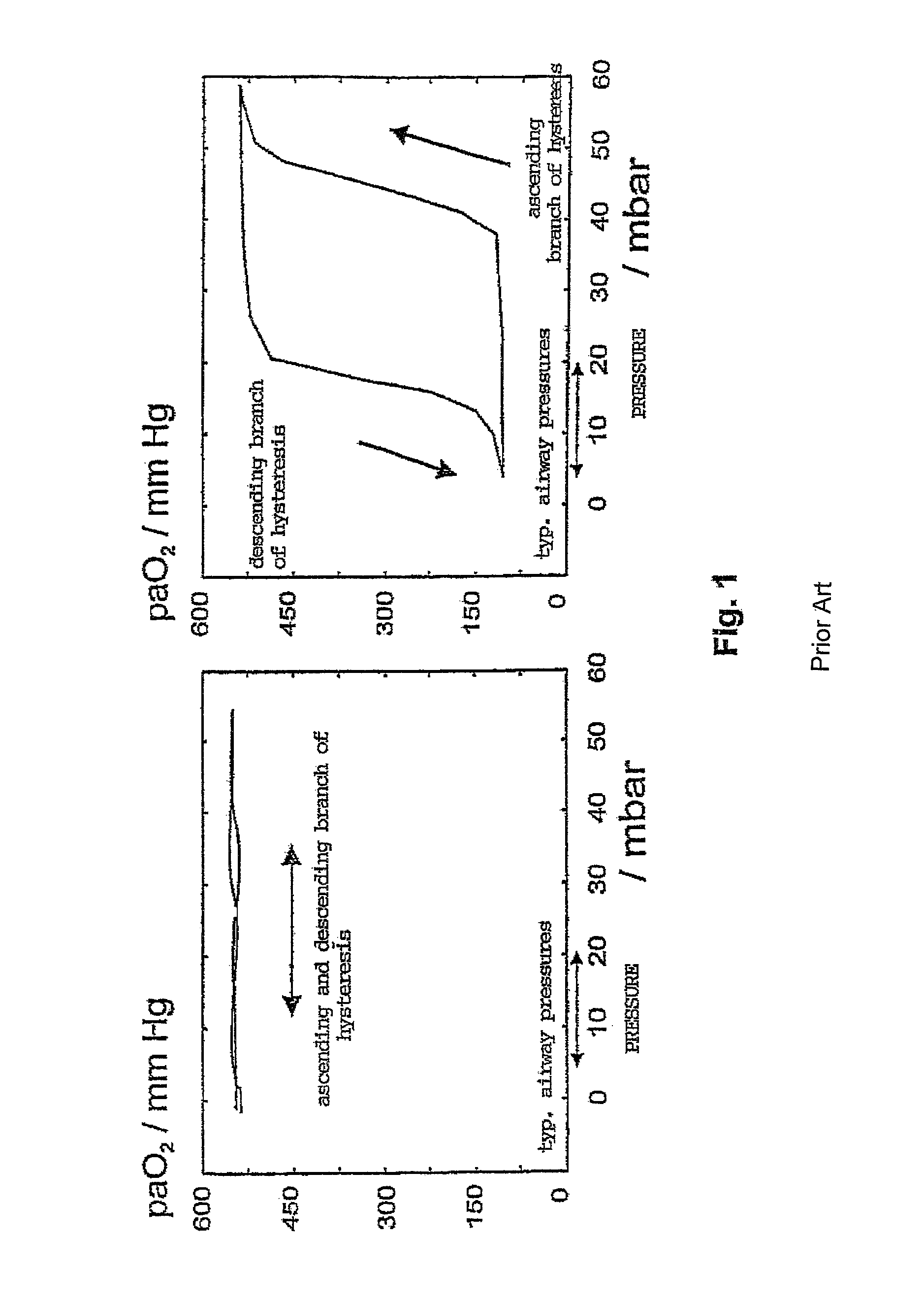 Non-invasive method and apparatus for optimizing the respiration of atelectatic lungs