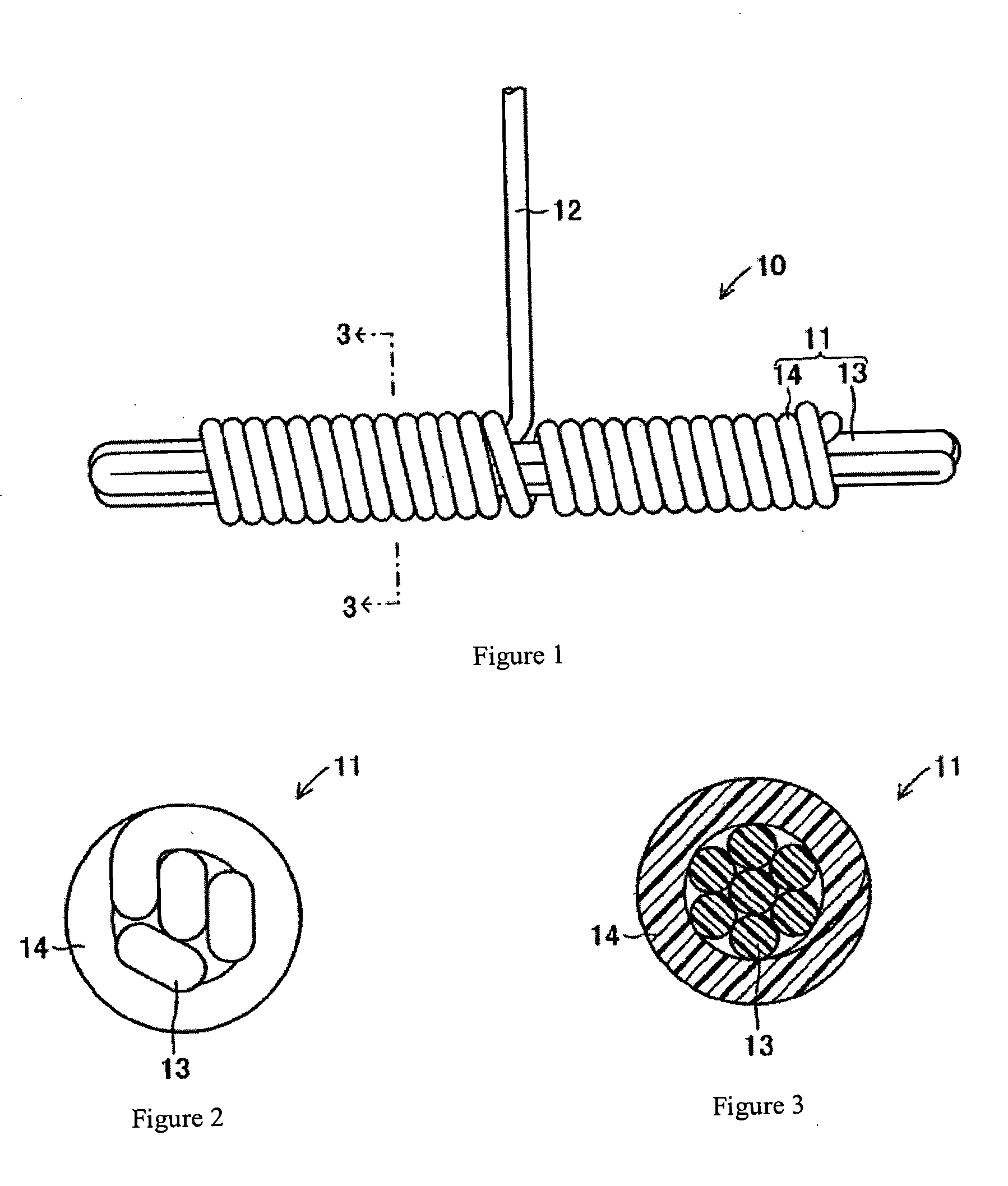 Surgical Fastener, Surgical Fastener Kit and Removing Tool