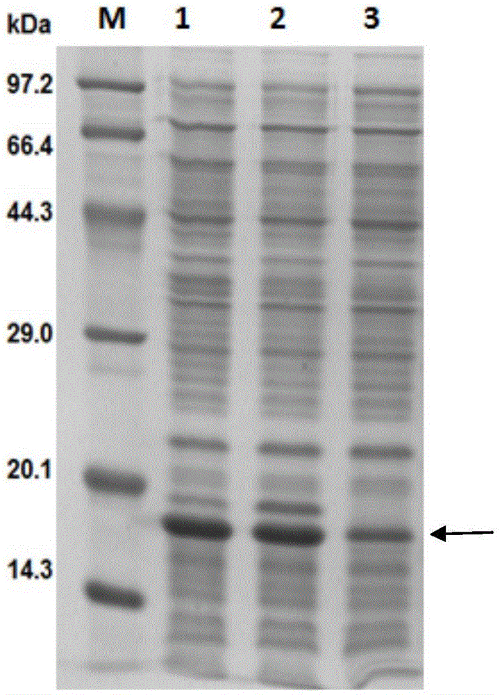 Anti-human amyloid beta-peptide nano antibody and application thereof