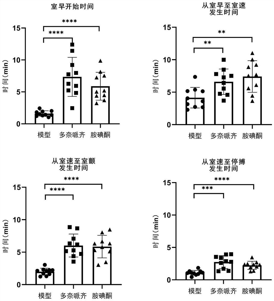 Application of donepezil in preparation of medicine for treating arrhythmia