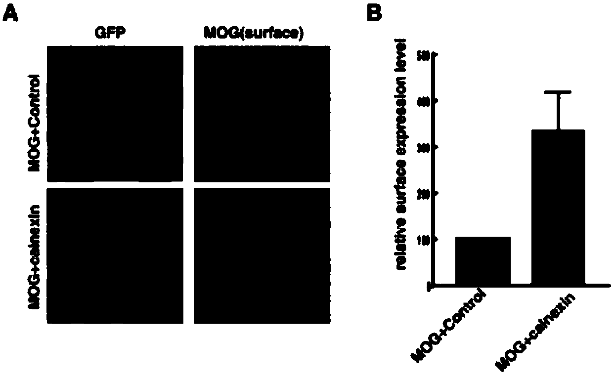 Detection method of human myelin oligodendrocyte glycoprotein autoimmune antibody