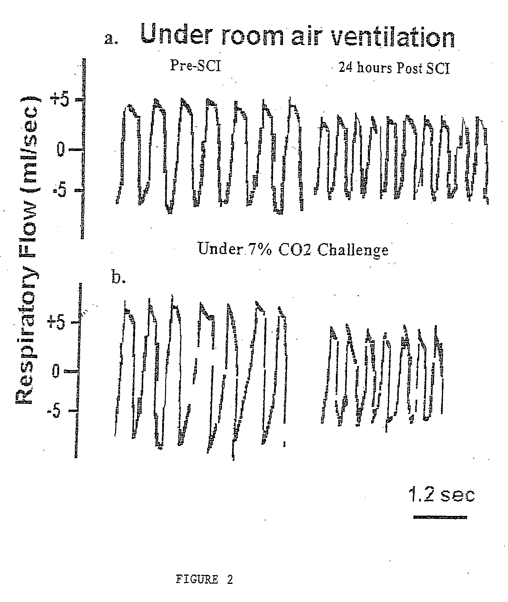 Method for improving respiratory function and inhibiting muscular degeneration