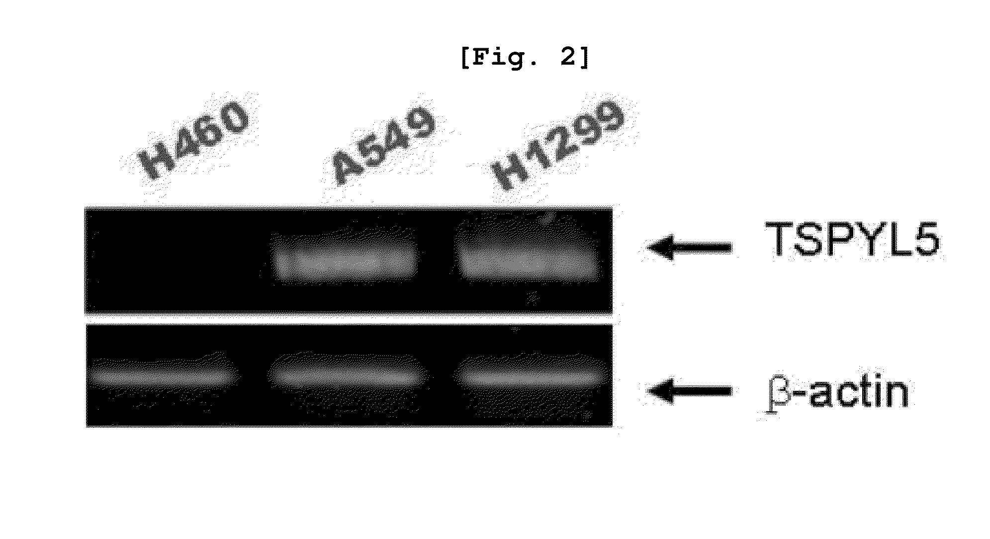 Method for enhancing chemical sensitivity or radiosensitivity of cancer cells by inhibiting expression of tspyl5