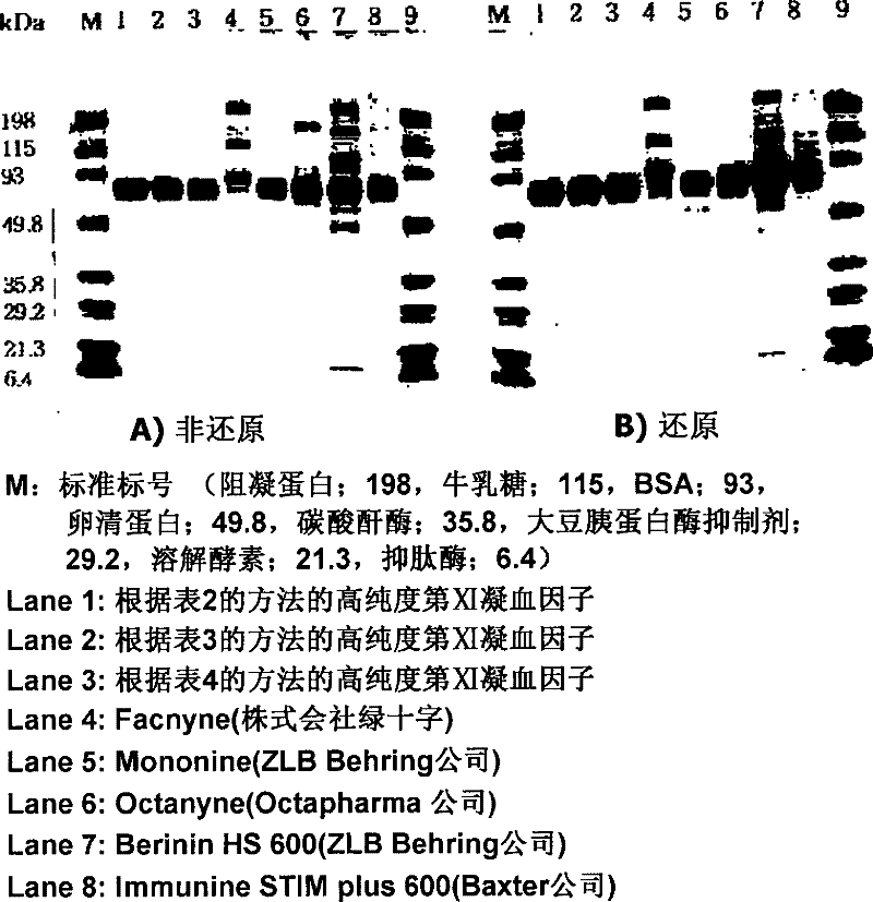 Method for manufacturing high purified factor IX