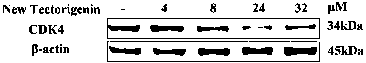 CDK inhibitor and application thereof